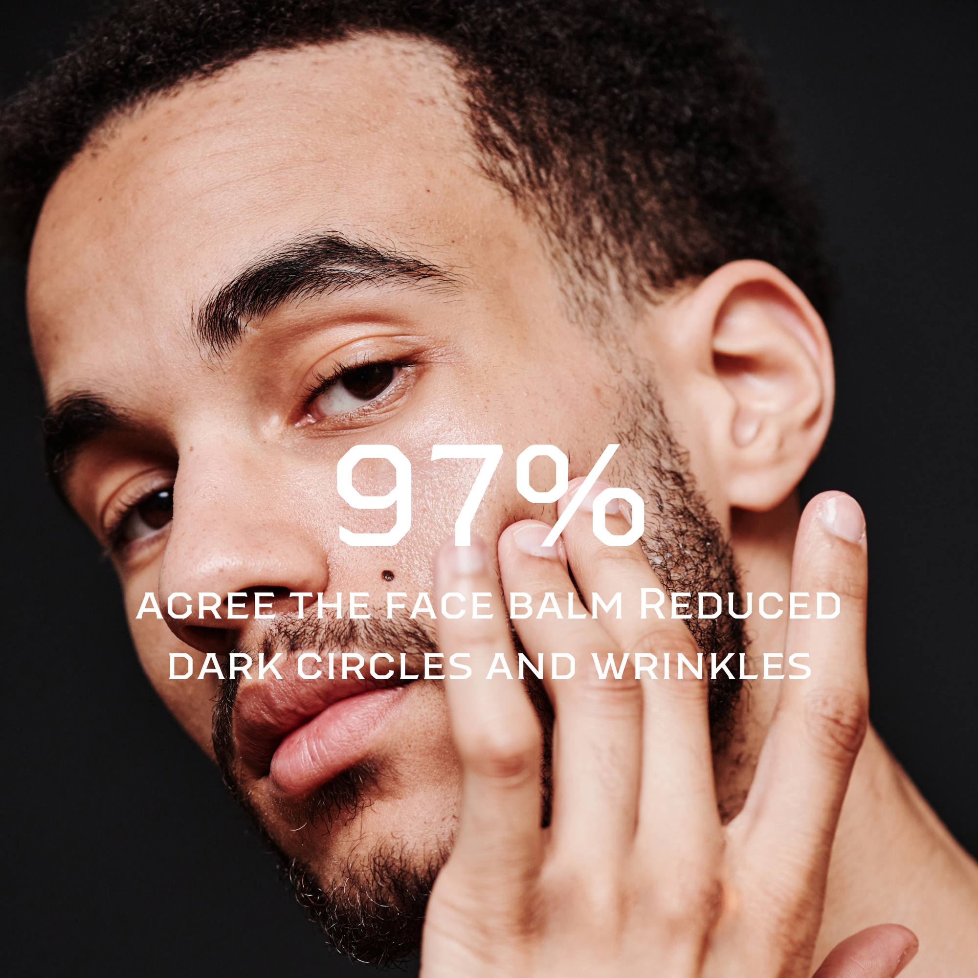 Pre-Order | Face Balm